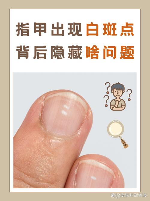 指甲问题看什么科
