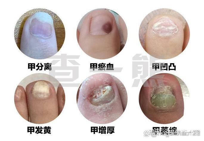 指甲问题看什么科