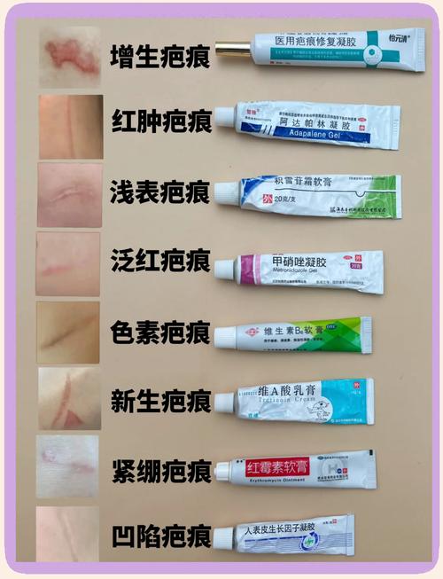 去疤痕什么好