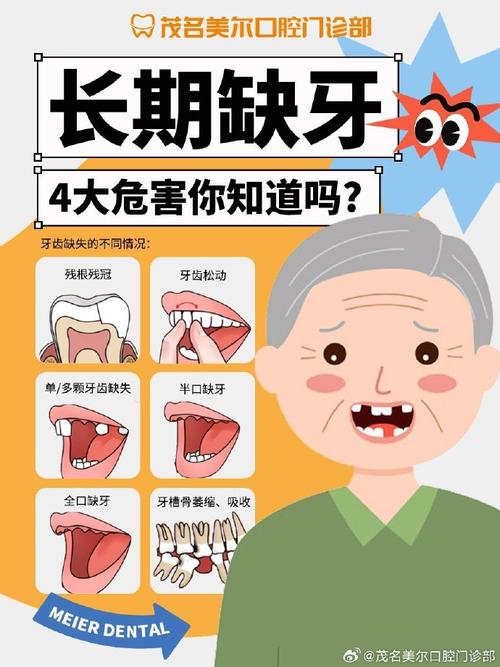 为什么缺牙