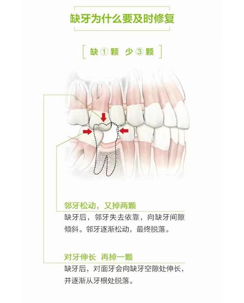 为什么缺牙