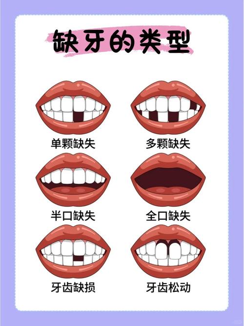 为什么缺牙