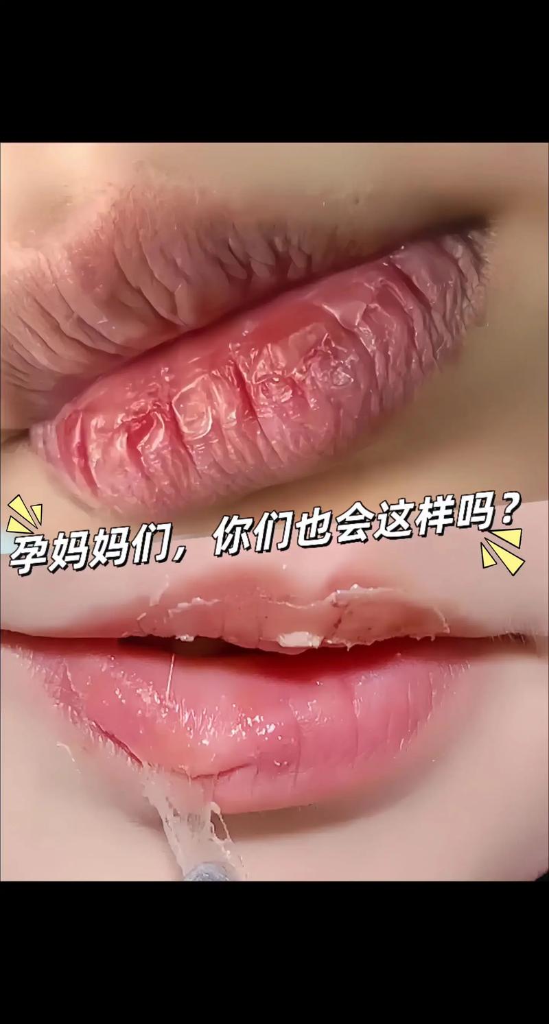 孕唇是什么