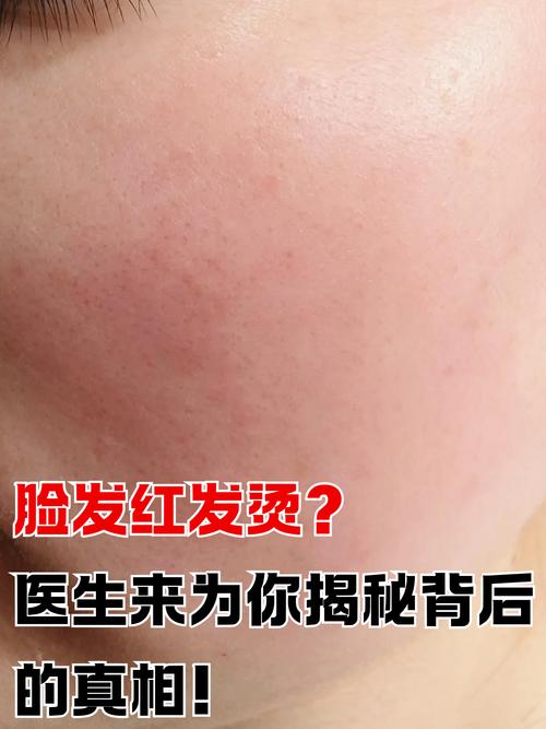脸颊发烫是什么原因