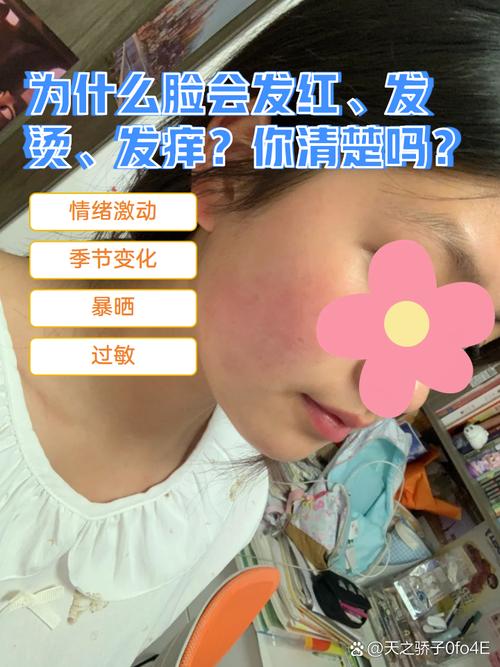 脸颊发烫是什么原因