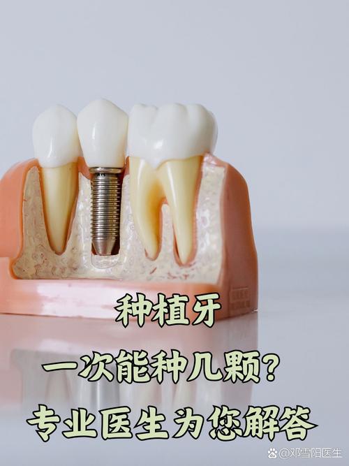 牙植骨是什么意思