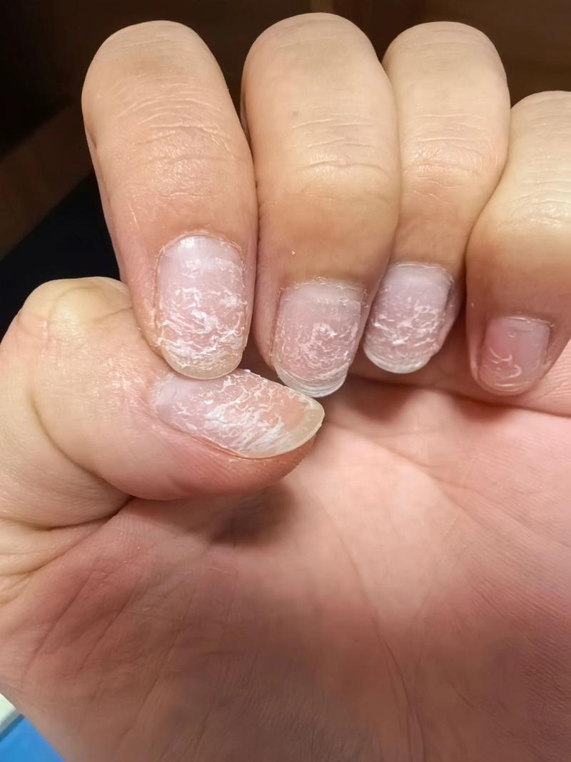 美甲为什么要磨指甲