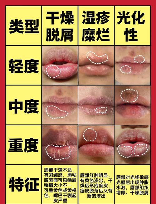 嘴唇暗红是什么原因