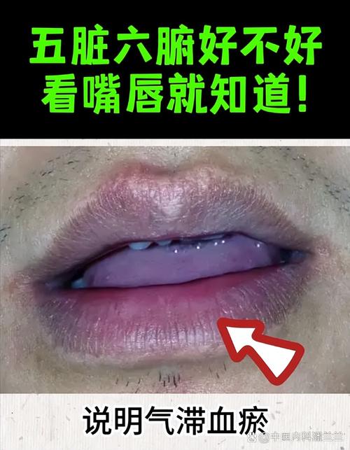 嘴唇暗红是什么原因