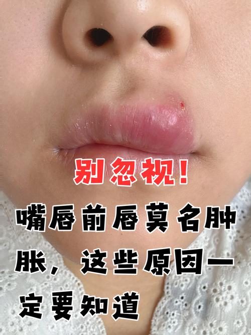 嘴唇暗红是什么原因