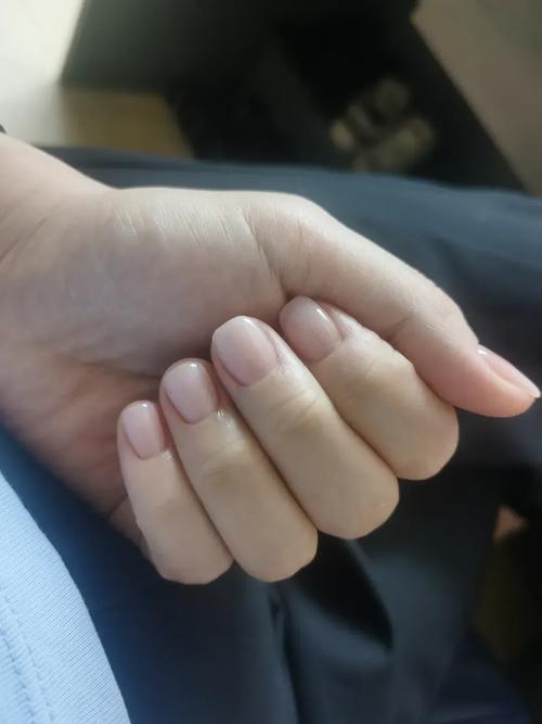 为什么指甲越来越短