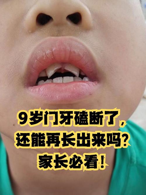 大门牙什么时候换