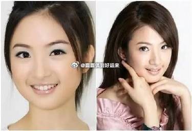 为什么会有婴儿肥
