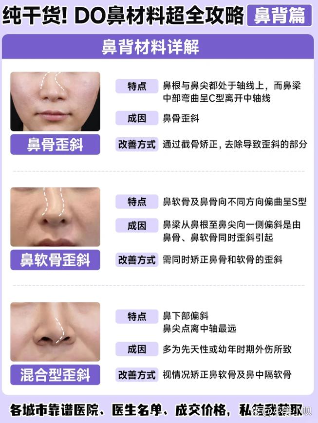 为什么会鼻子歪