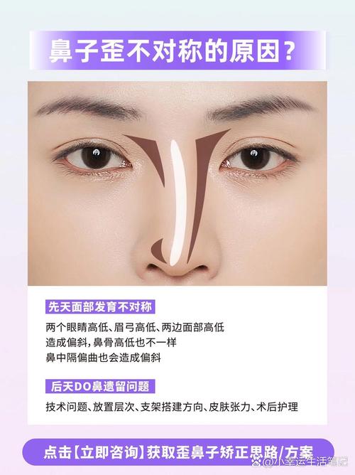 为什么会鼻子歪