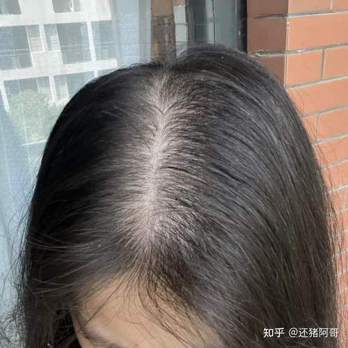 什么是油性发质