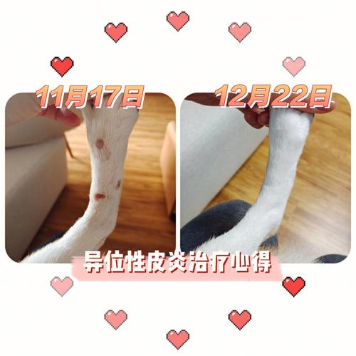 异位性皮炎是什么
