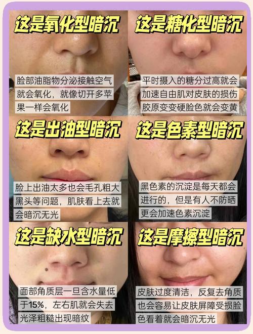 女人脸黄是什么原因