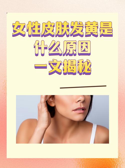 女人脸黄是什么原因