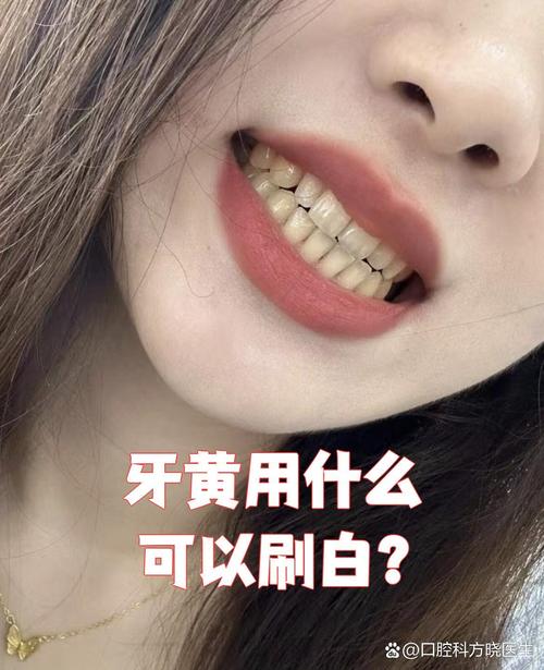 吃什么牙齿会变黄