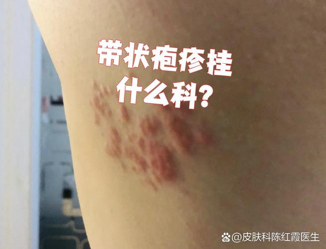 皮肤感染挂什么科