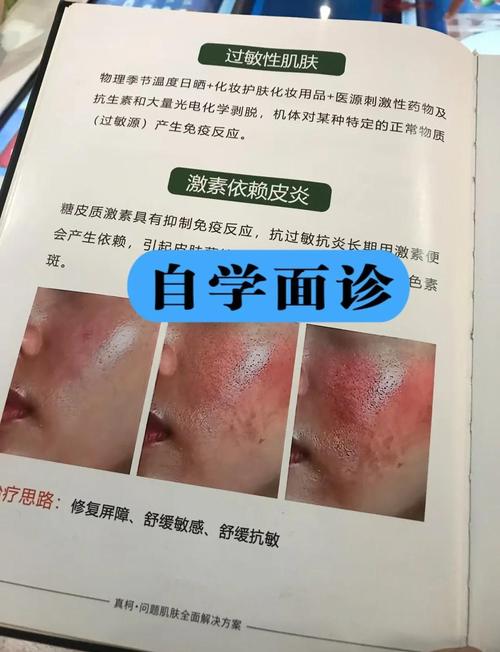皮肤感染挂什么科