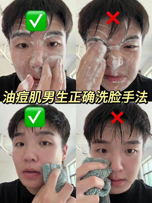 脸上长痘用什么洗脸
