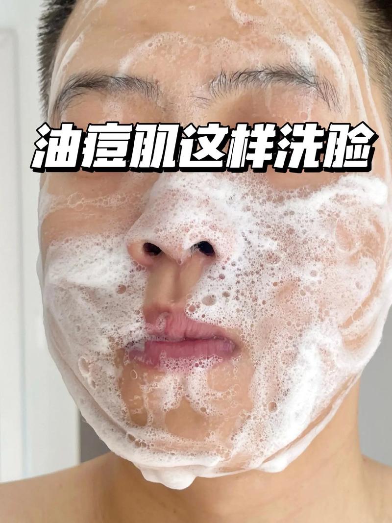 脸上长痘用什么洗脸