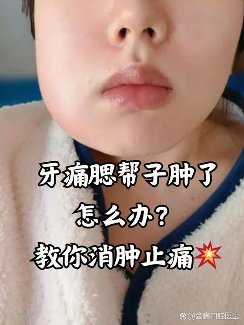 牙疼脸肿挂什么科