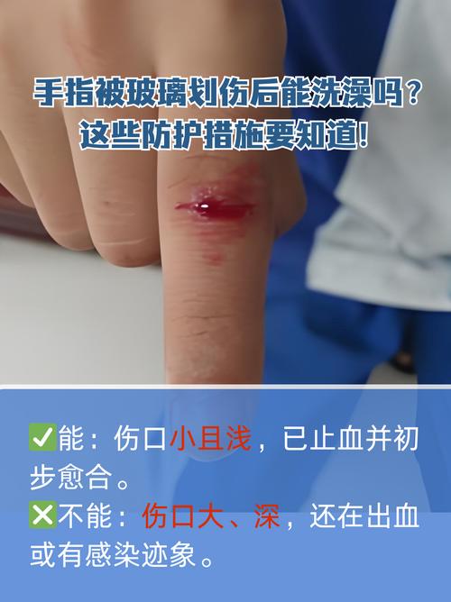 为什么伤口不能沾水