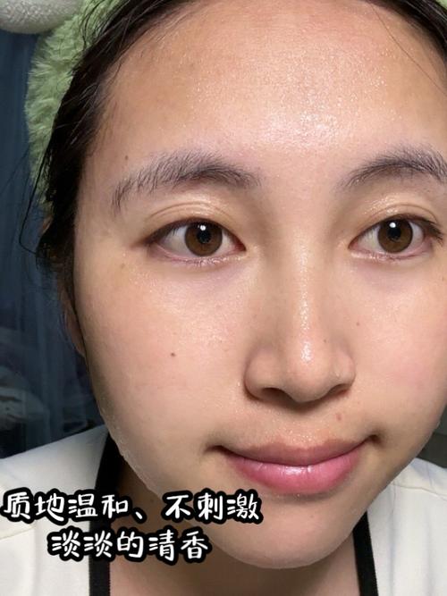 用完洗面奶额头痒是怎么