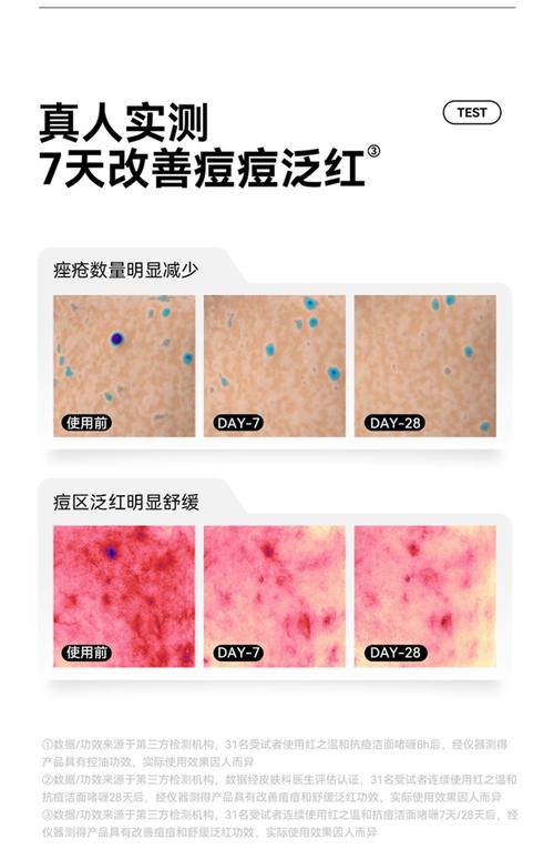用完洗面奶脸上发红是怎么回事