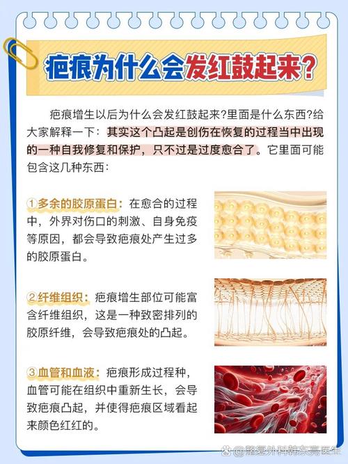 伤疤为什么会增生
