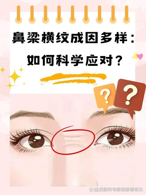 鼻梁有横纹代表什么