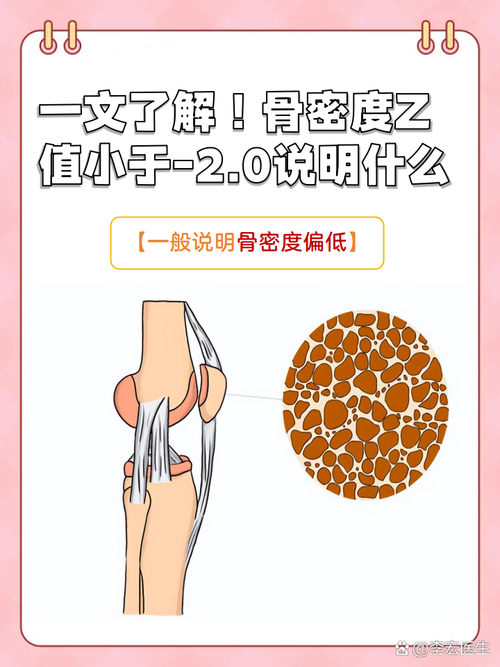 低骨是什么
