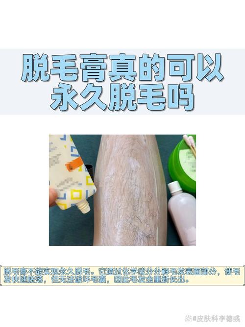 永久脱毛什么最好