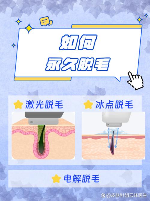 永久脱毛什么最好