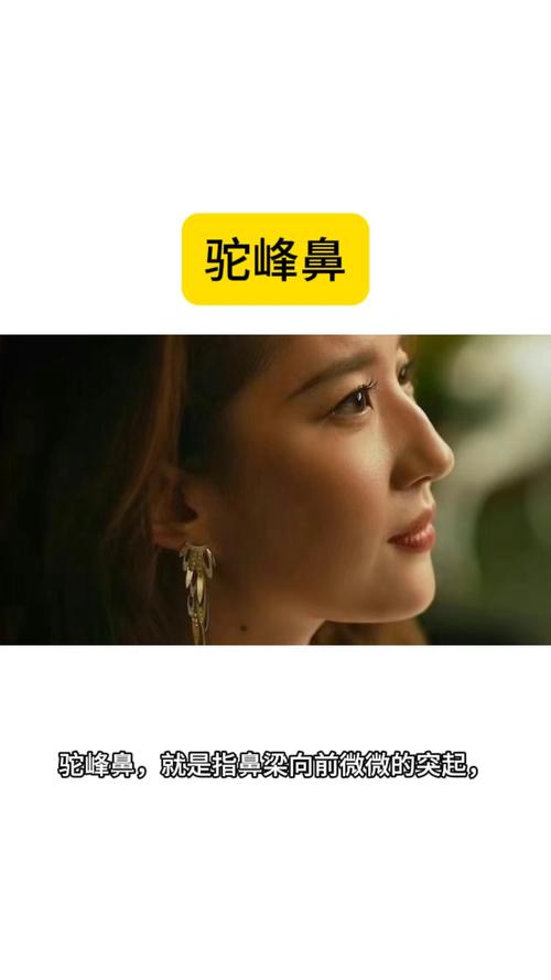 什么是驼峰鼻