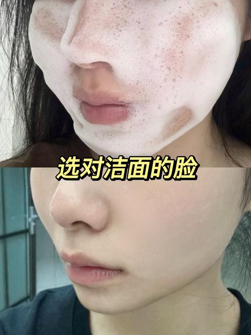 洗面奶用完后很干怎么办