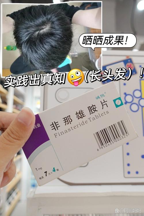 非那雄胺什么时候吃