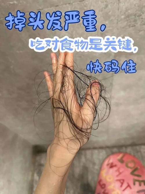 经常掉头发吃什么好