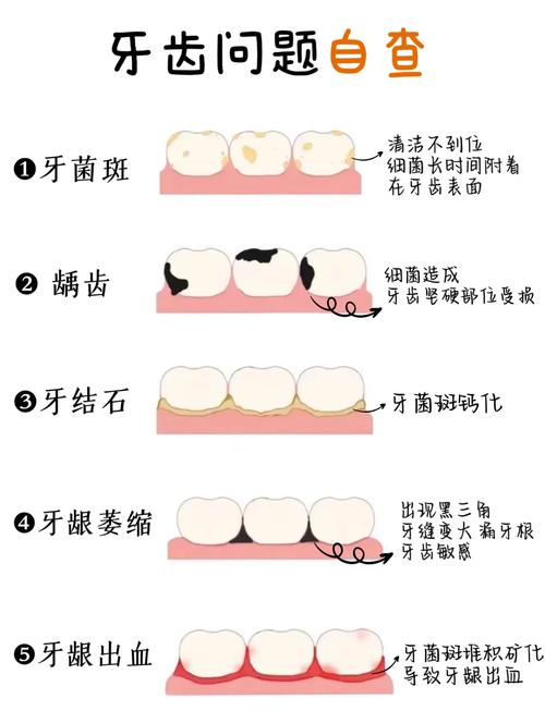 牙缝臭是什么原因