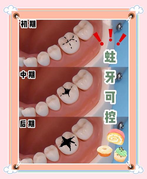 牙缝臭是什么原因