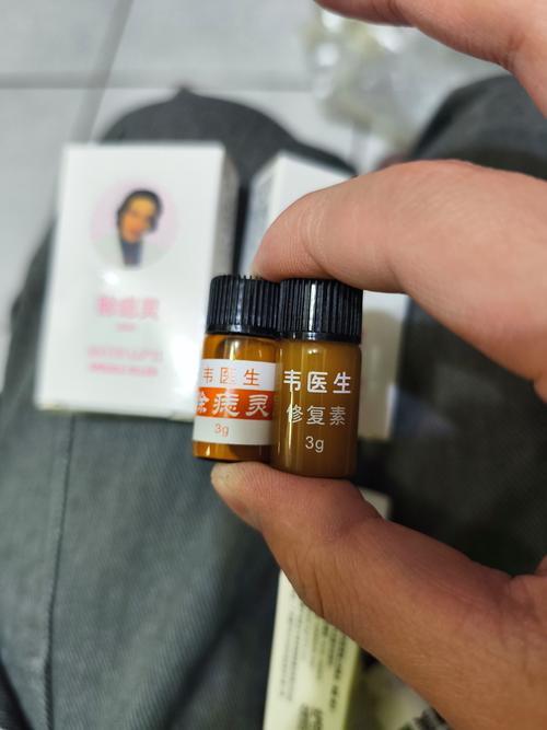 点痣用什么方法好