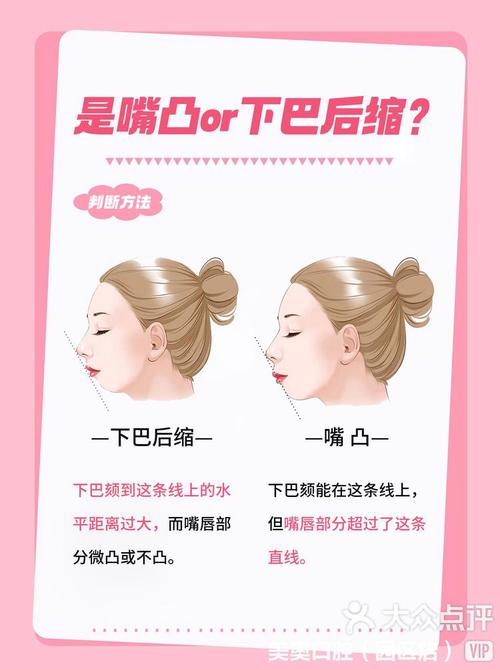 为什么会下巴后缩
