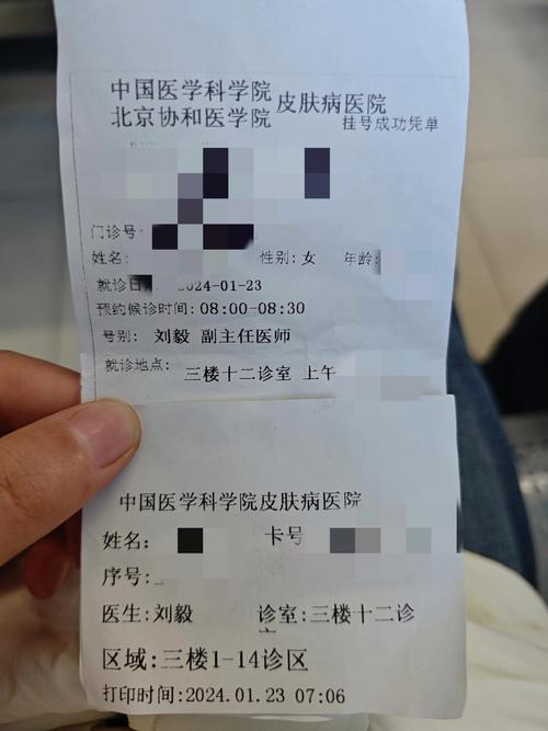 激光祛斑挂什么科