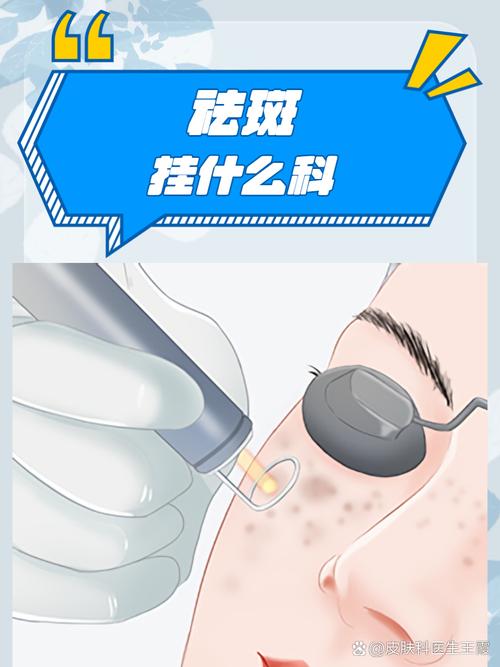 激光祛斑挂什么科