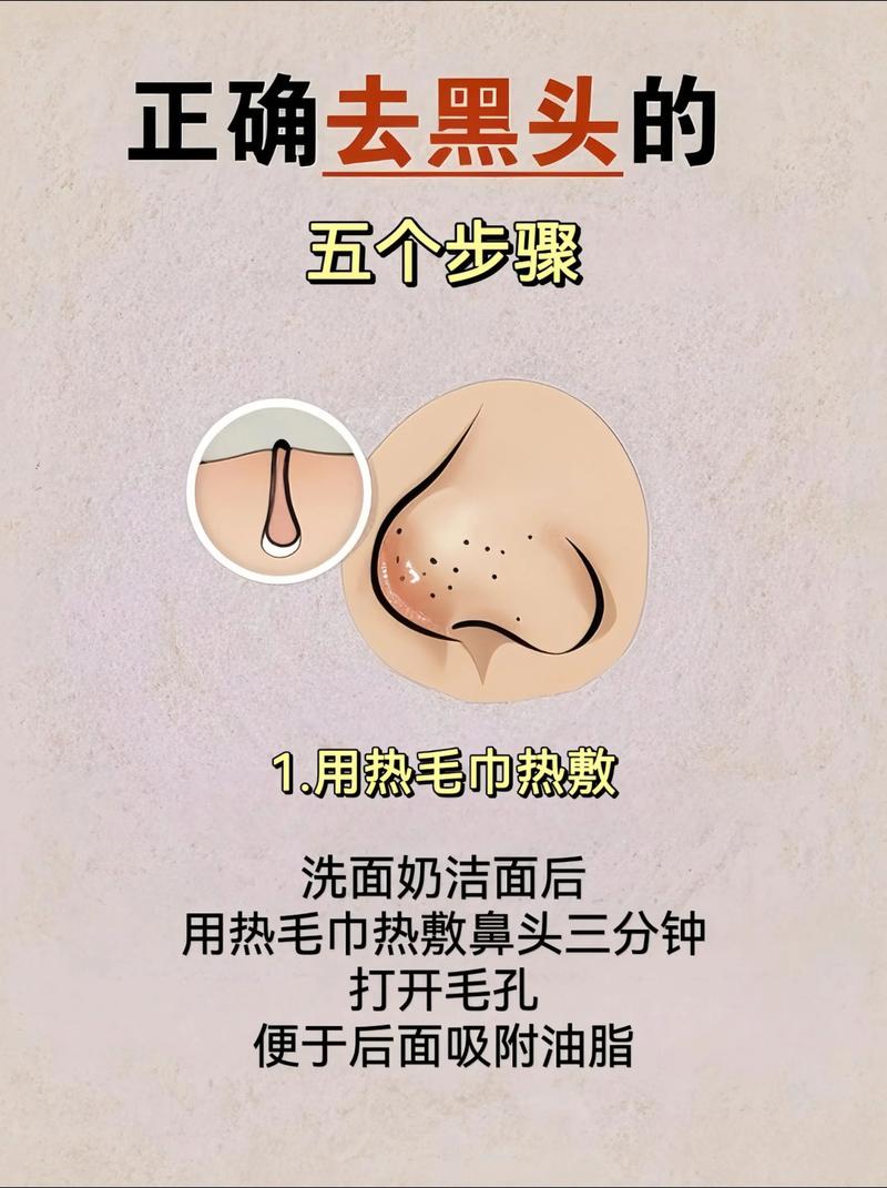 去黑头有什么好处