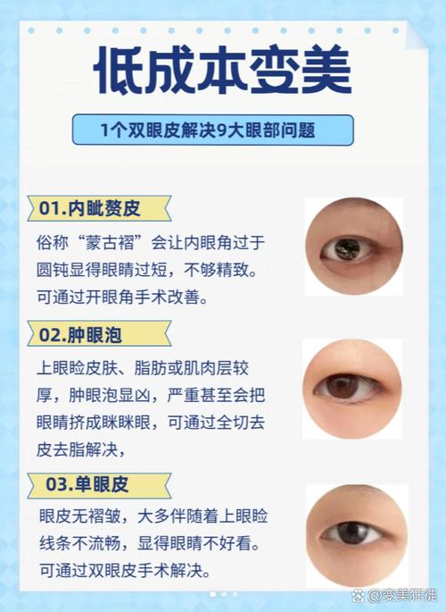 蒙古褶是什么