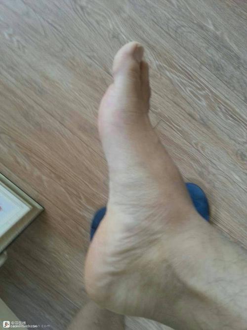 什么是脚背高